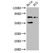 WB analysis of HeLa and PC3 whole cell lysates, using GLB1 antibody (4 µg/ml). Predicted band size: 61, 73, 77 kDa, Observed band size: 77 kDa.