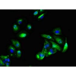 GTPase KRas (KRAS) Antibody