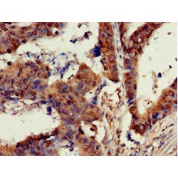 GTPase KRas (KRAS) Antibody