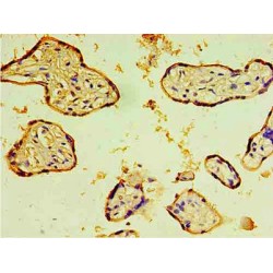 Membrane Cofactor Protein (CD46) Antibody