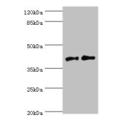 abx302453