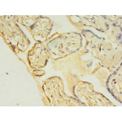 Ubiquitin Conjugating Enzyme E2C (UBE2C) Antibody