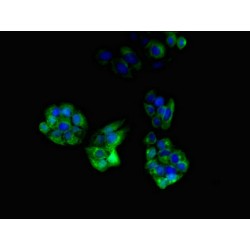 Perilipin 4 (PLIN4) Antibody