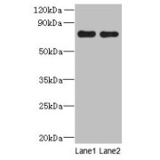 WB analysis of (1) A549, and (2) HCT116 whole cell lysates, using ACTR8 antibody (16 µg/ml). Calculated band size: 71, 59, 37 kDa; Observed band size: 71 kDa.