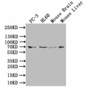 WB analysis of (1) PC-3 whole cell lysates, (2) HL60 whole cell lysates, (3) mouse brain tissue, and (4) mouse liver tissue, using SLC6A6 antibody (1/1000 dilution). Predicted band size: 70 kDa, Observed band size: 70 kDa.