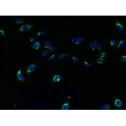 Transmembrane Protein 165 (TMEM165) Antibody