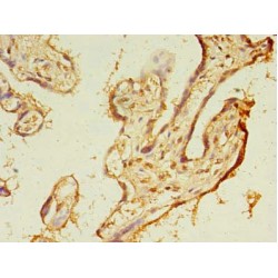 Transmembrane Protein 165 (TMEM165) Antibody