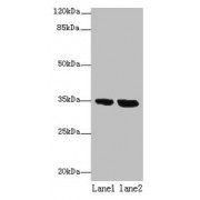 WB analysis of (1) Jurkat, and (2) HeLa whole cell lysates, using TMEM165 antibody (8 µg/ml). Predicted band size: 29, 35 kDa, Observed band size: 35 kDa.