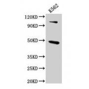 WB analysis of K562 whole cell lysates, using ARBB1 antibody (4.6 µg/ml).