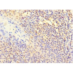 Polymerase DNA Directed Beta (POLB) Antibody