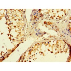 Polymerase DNA Directed Beta (POLB) Antibody