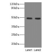 WB analysis of (1) A549, and (2) U251 whole cell lysates, using NEU3 antibody (2 µg/ml). Predicted band size: 49, 52 kDa, Observed band size: 49 kDa.