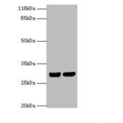 HLA Class II Histocompatibility Antigen, DRB1-1 Beta Chain (HLA-DRB1) Antibody