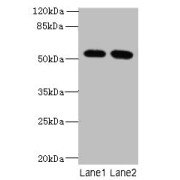 Western blot analysis of HeLa (Lane 1) and NIH/3T3 (Lane 2) whole cell lysates using Integrator Complex Subunit 14 Antibody (4 µg/ml) followed by Goat Anti-Rabbit IgG secondary antibody (1/10000 dilution).<p></p>Calculated MW: 58 kDa, 51 kDa, 49 kDa, 10 kDa<br>Observed MW: 58 kDa