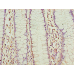 FAD Synthase (FLAD1) Antibody