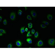 IF analysis of MCF-7 cells, using SLC7A3 Antibody (1/100 dilution) and AF488-conjugated Goat anti-Rabbit IgG (H+L).