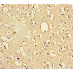DEAD/H (Asp-Glu-Ala-Asp/His) Box Polypeptide 35 (DHX35) Antibody