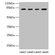WB analysis of (1) mouse kidney tissue, (2) mouse liver tissue, (3) K562 whole cell lysate, and (4) HeLa whole cell lysate, using DHX35 antibody (12 µg/ml) and goat anti-rabbit IgG secondary antibody (1/10000 dilution). Predicted band size: 76, 79 kDa, Observed band size: 79 kDa.