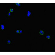 IF analysis of HepG2 cells, using CLCN1 antibody (1/100 dilution) and AF488-conjugated Goat anti-Rabbit IgG (H+L).