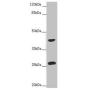 WB analysis of HeLa whole cell lysates, using RAB12 antibody (2 µg/ml). Predicted band size: 27 kDa. Observed band size: 27, 42 kDa.