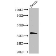 Western blot analysis of Mouse brain tissue using B4GALT7 antibody (3 µg/ml).