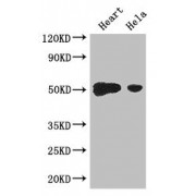 WB analysis of mouse heart tissue and HeLa whole cell lysates, using TFDP2 Antibody (3.2 µg/ml). Predicted band size: 50, 41, 42, 43, 40, 35, 47 kDa. Observed band size: 50 kDa.