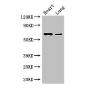 WB analysis of (1) mouse heart tissue, and (2) mouse lung tissue, using DCAF8 antibody (3.5 µg/ml). Predicted band size: 31 kDa, 67 kDa; Observed band size: 67 kDa