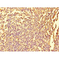 Fidgetin (FIGN) Antibody