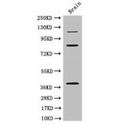 E3 Ubiquitin-Protein Ligase PDZRN3 (PDZRN3) Antibody