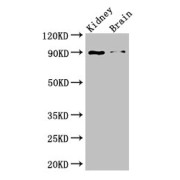abx318199