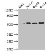 WB analysis of K562, Jurkat and HepG2 whole cell lysates, and Mouse Brain tissue, using SLC16A8 antibody (3 µg/ml), with Goat anti-Rabbit IgG antibody (1/50000 dilution). Predicted band size: 53 kDa, Observed band size: 53 kDa.