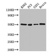 WB analysis of: K562 whole cell lysate, PC-3 whole cell lysate, U251 whole cell lysate, and Mouse brain tissue, using TUBA1C antibody (3 µg/ml).