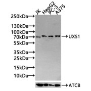 WB analysis of JK, HepG2, PC-3, A375 whole cell lysates (20 µg per lane), using UXS1 antibody (1/1000 dilution) with <a href="https://www.abbexa.com/index.php?route=product/search&search=abx400043" target="_blank">abx400043</a> - Goat anti-Rabbit IgG antibody (1/20000 dilution).Calculated MW: 29 kDa, 48 kDa, 49 kDa, Observed MW: 70 kDa-100 kDa.