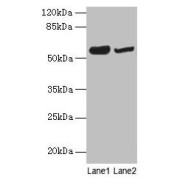 WB analysis of (1) Mouse Heart Tissue, and (2) Mouse Brain Tissue, using NOSTRIN antibody (6 µg/ml). Predicted band size: 49, 55, 58, 65 kDa, Observed band size: 58 kDa.