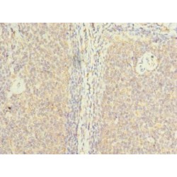 Zinc Fingers and Homeoboxes Protein 1, Isoform 2 (ZHX1-C8orf76) Antibody