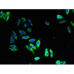 Neuromedin U Receptor 1 (NMUR1) Antibody