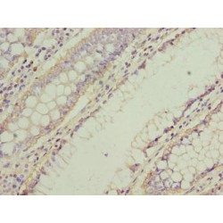 Neuromedin U Receptor 1 (NMUR1) Antibody