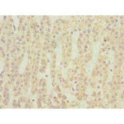 Neuromedin U Receptor 1 (NMUR1) Antibody