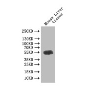 Western blot analysis of Mouse liver tissue using GDNF Family Receptor Alpha-Like Antibody (1/1000 dilution) and Goat Anti-Rabbit IgG secondary antibody (1/50000 dilution). <p></p>Calculated MW: 45 kDa<br>Observed MW: 55 kDa
