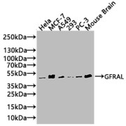 Western blot analysis of various whole cell lysates (20 µg) using GDNF Family Receptor Alpha-Like Antibody (1/1000 dilution) and Goat Anti-Rabbit IgG secondary antibody (1/20000 dilution). Calculated MW: 45 kDa, Observed MW: 45 kDa.