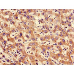 Protein Phosphatase 2 Catalytic Subunit Alpha (PPP2CA) Antibody