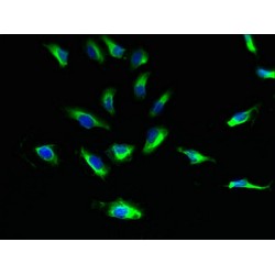 Succinate Receptor 1 (SUCNR1) Antibody