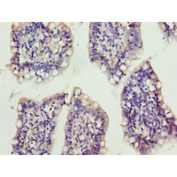 X-Ray Radiation Resistance-Associated Protein 1 (XRRA1) Antibody