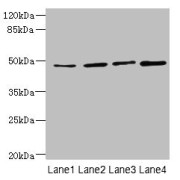 WB analysis of (1) HepG2 whole cell lysates, (2) A549 whole cell lysates, (3) MCF-7 whole cell lysates, and (4) mouse kidney tissue, using TTC5 Antibody (6 µg/ml). Predicted band size: 49 kDa, Observed band size: 49 kDa.