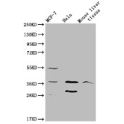 Western blot analysis of MCF-7 (Lane 1), HeLa (Lane 2) cells and Mouse liver tissue (Lane 3) using Mas-Related G-Protein Coupled Receptor Member X2 Antibody (1/2000 dilution) followed by Goat Anti-Rabbit IgG (1/50000 dlution). <p></p>Calculated MW: 38 kDa<br>Observed MW: 38 kDa