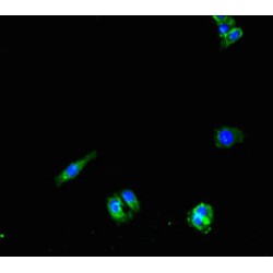 Patatin-Like Phospholipase Domain-Containing Protein 1 (PNPLA1) Antibody