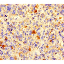 Natural Cytotoxicity Triggering Receptor 3 Ligand 1 (NCR3LG1) Antibody