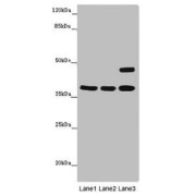 Western blot analysis (1) Thp1 whole cell lysates, (2) K562 whole cell lysates, and (3) Mouse brain tissue, using MR1 antibody (6 µg/ml) and Goat anti-Rabbit IgG polyclonal secondary antibody (1/10000 dilution).
