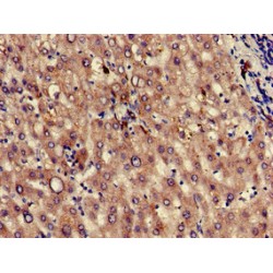 Plasma Kallikrein (KLKB1) Antibody
