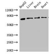 WB analysis of (1) HepG2 whole cell lysates, (2) Rat liver tissue, (3) Rat brain tissue, and (4) Mouse heart tissue, using KLKB1 antibody (2.5 µg/ml). Predicted band size: 72 kDa, Observed band size: 72 kDa.